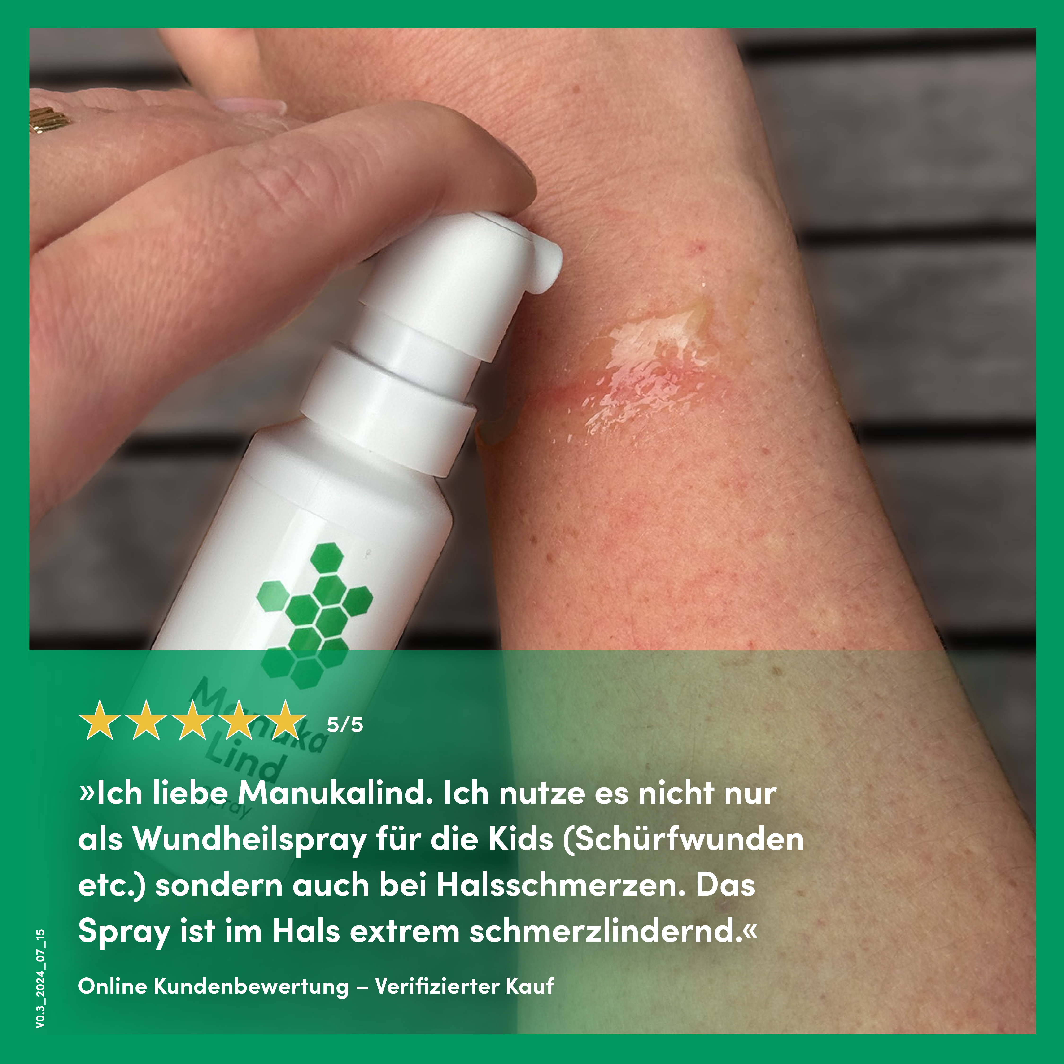 ManukaLind Wundheilspray mit antibakteriellem Manuka-Honig (MGO 514+), für alle Phasen der Wundheilung, viele Wundarten und Hautirritationen, Fördert die Heilung schwerwiegender Wunden, 30ml 