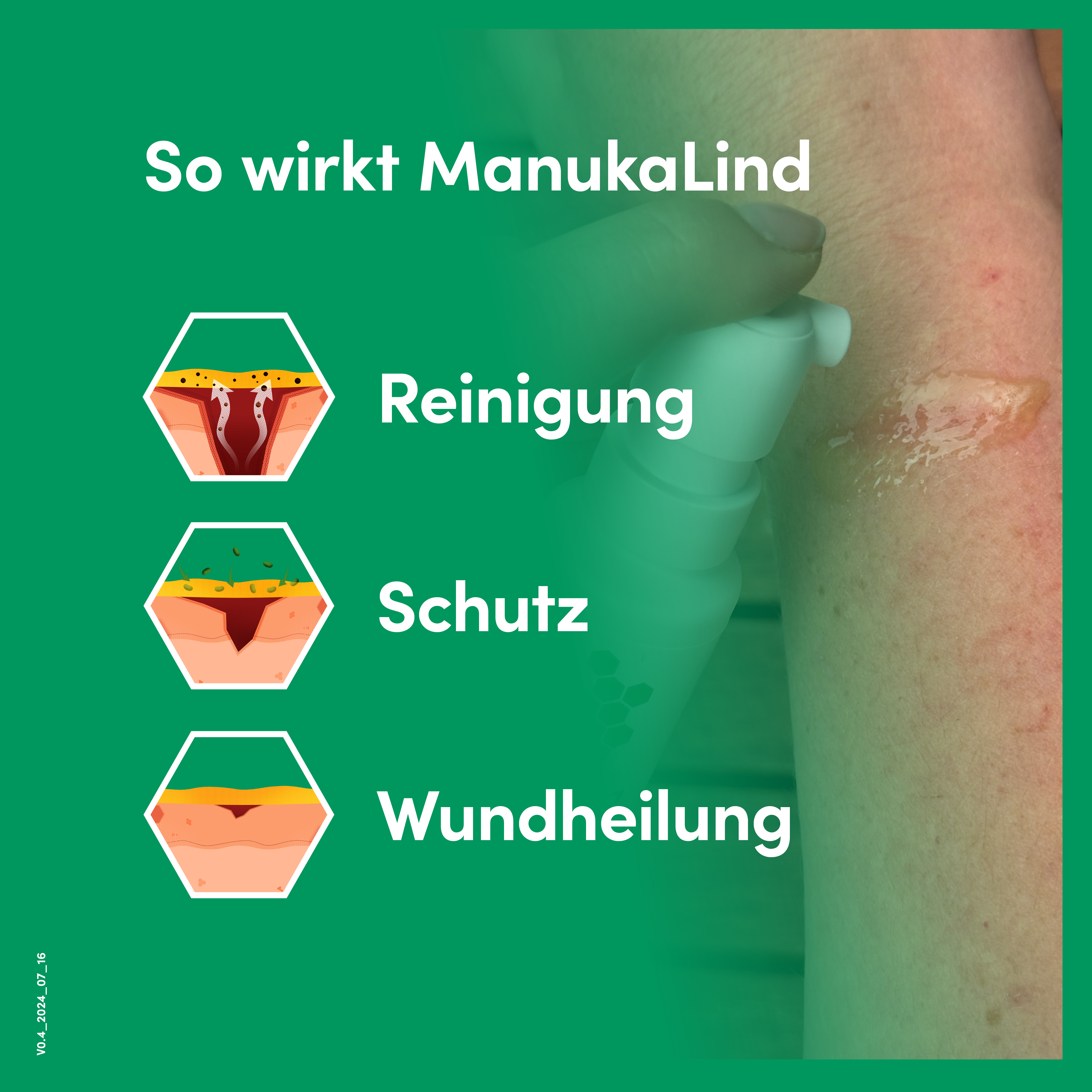 ManukaLind Wundheilspray mit antibakteriellem Manuka-Honig (MGO 514+), für alle Phasen der Wundheilung, viele Wundarten und Hautirritationen, Fördert die Heilung schwerwiegender Wunden, 30ml 